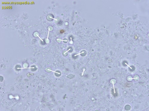 Tricholoma terreum - Sporen - Wasser  - 