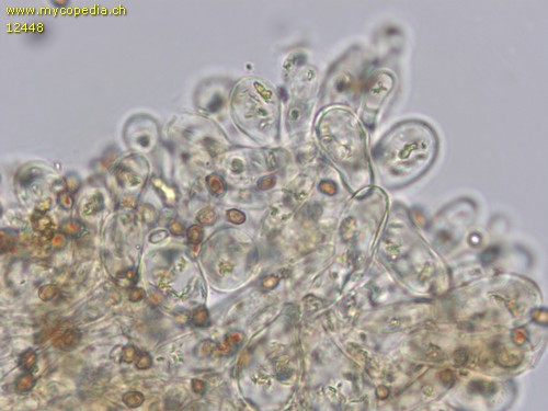 Agaricus luteomaculatus - Marginalzellen - 