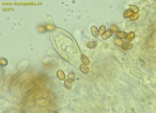 Pyrrhulomyces astragalinus - Chrysozystiden - KOH  - 
