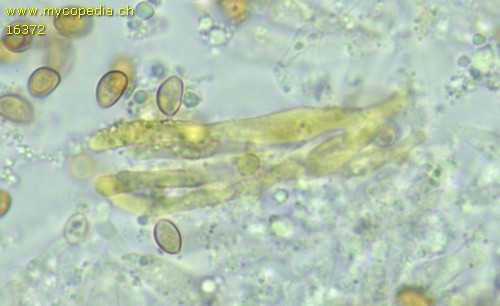Pyrrhulomyces astragalinus - Cheilozystiden - KOH  - 