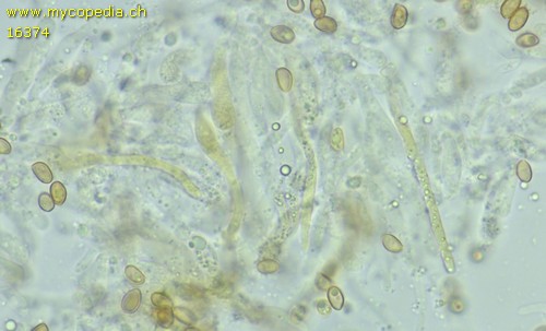 Pyrrhulomyces astragalinus - Cheilozystiden - KOH  - 