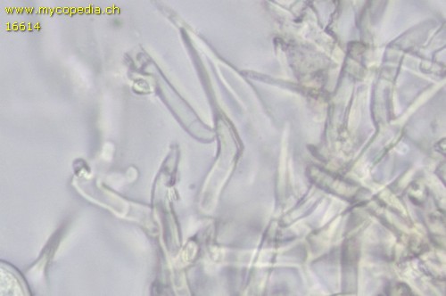 Lyomyces crustosus - Zystiden - 
