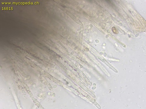 Lachnellula calyciformis - Haare - 