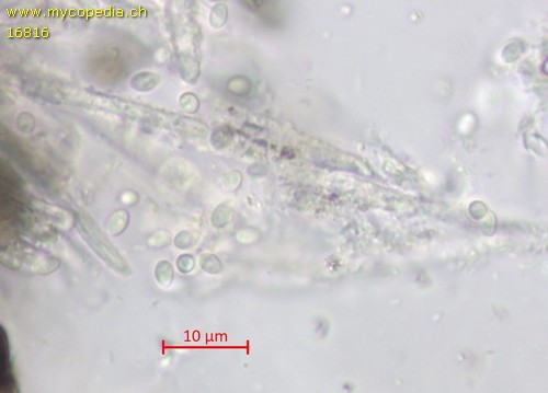 Lachnellula calyciformis - Sporen - 