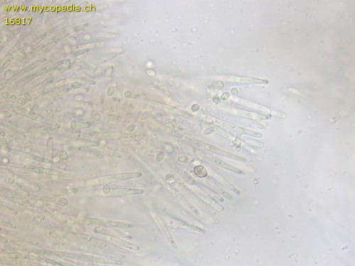 Lachnellula calyciformis - Paraphysen - 