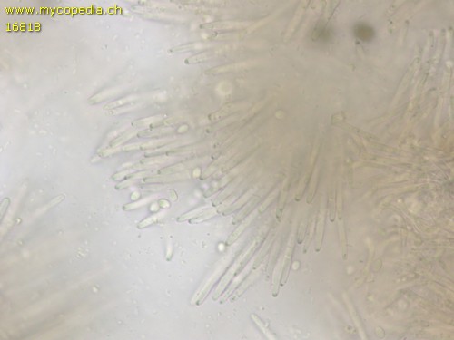 Lachnellula calyciformis - Basidien - 