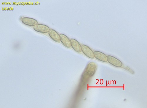 Phomatospora berkeleyi - 