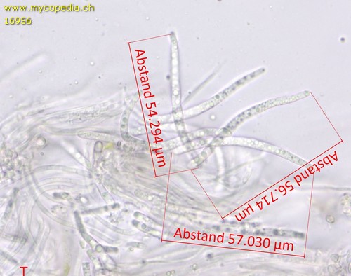 Karstenia idaei - Sporen - Wasser  - 