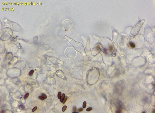 Coprinopsis stercorea - Cheilozystiden - 