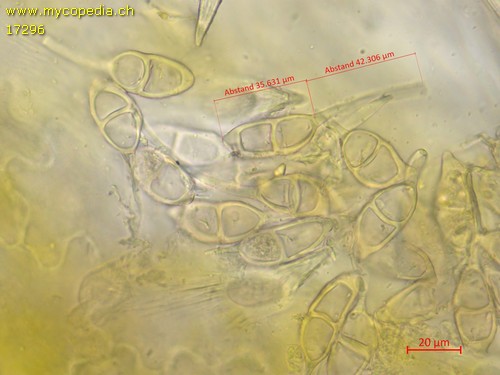 Puccinia glechomatis - Konidien - Wasser  - 