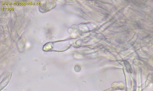 Clavulina cinerea - Zystiden metuloid - 