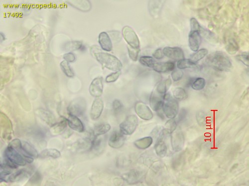 Pseudotricholoma metapodium - Sporen - Melzers  - 