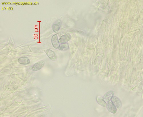 Pseudotricholoma metapodium - 