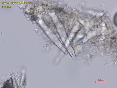 Tubulicrinis subulatus - Zystiden - Kongorot  - 