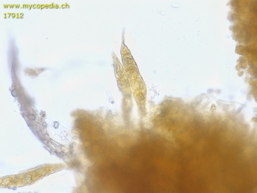 Scytinostromella heterogenea - Gloeozystiden - 