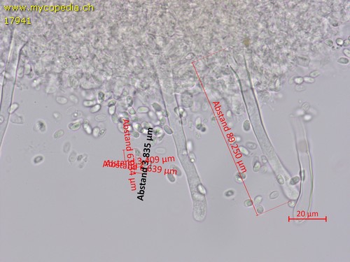 Lagarobasidium detriticum - 