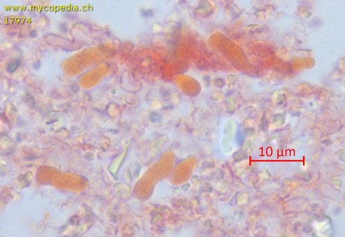 Trechispora microspora - Basidien - Kongorot  - 