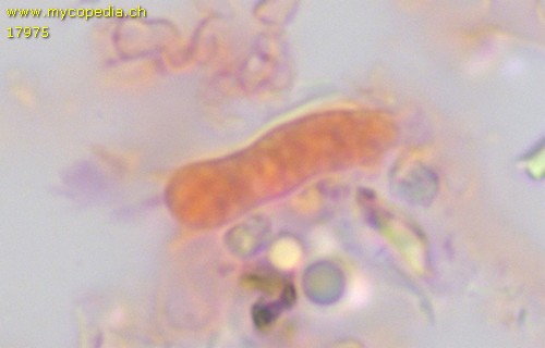 Trechispora microspora - Basidien - Kongorot  - 