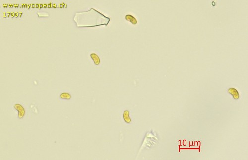 Peniophorella praetermissa - Spore/n - Melzers  - 