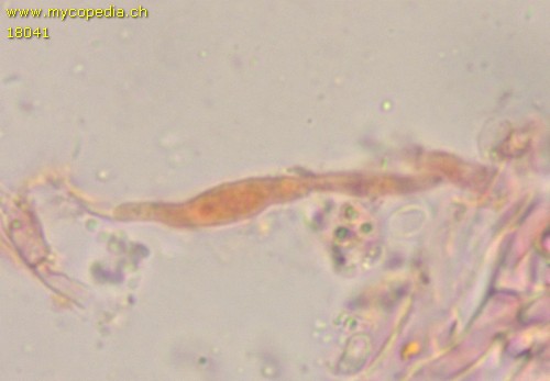 Phlebia livida - Zystiden - Kongorot  - 