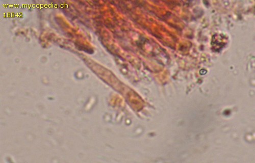 Phlebia livida - Basidien - 