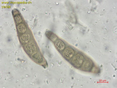 Bactrodesmium spec - 