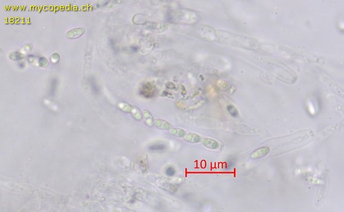 Phomatospora spec. - 