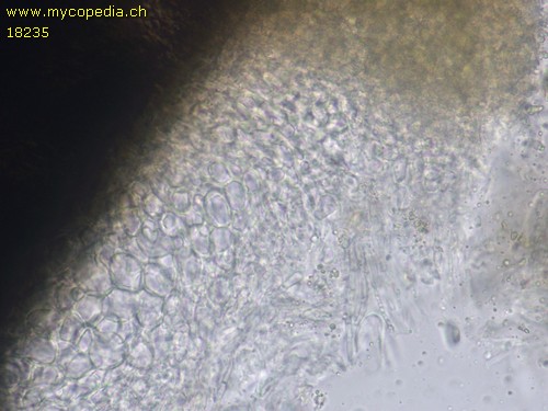 Praetumpfia obducens - Excipulum - 