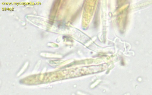 Pyrenopeziza atrata - 