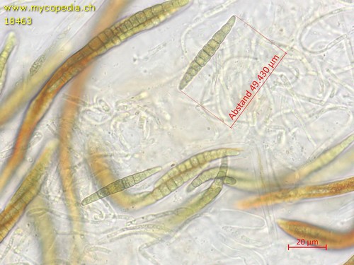 Leptosphaeria acuta - 