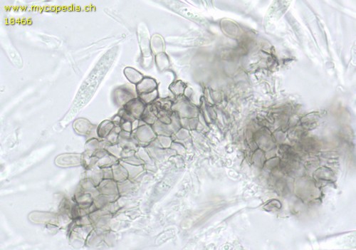 Pyrenopeziza atrata - Randhaare - KOH  - 