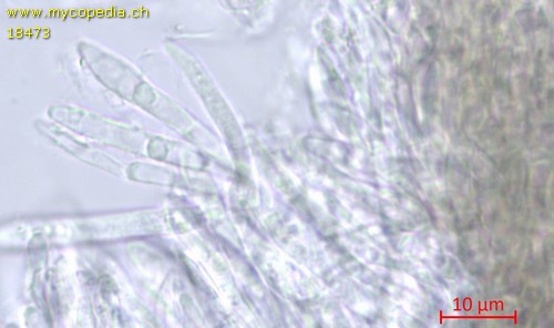 Pyrenopeziza atrata - Paraphysen - 
