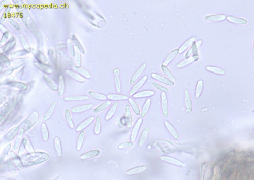 Pyrenopeziza atrata - Sporen & Asci - Wasser  - 