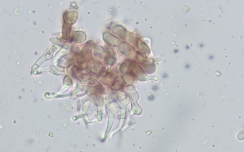 Unguiculariopsis lettaui - 