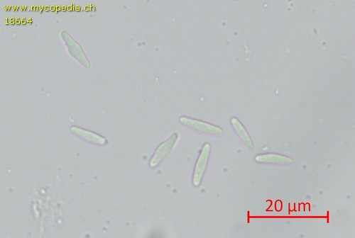 Pyrenopeziza fuckelii - 