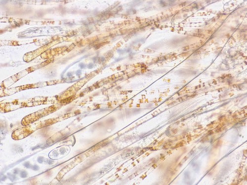 Anthracobia melaloma - Paraphysen - 