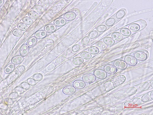 Anthracobia melaloma - Asci - Wasser  - 
