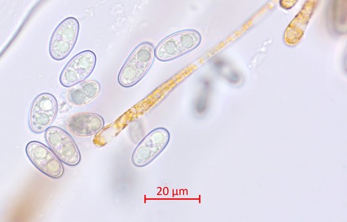 Anthracobia melaloma - Spore/n - Wasser  - 