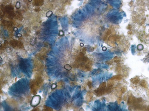 Dactylospora lignicol - 