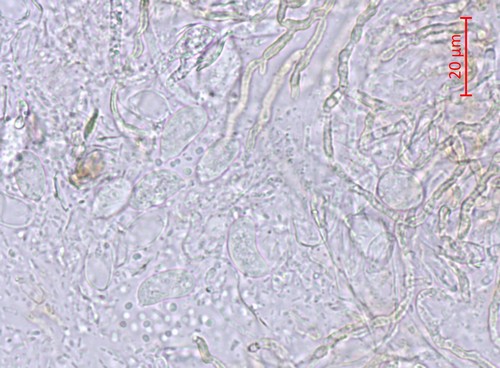Exidia spec - Spore/n - Wasser  - 