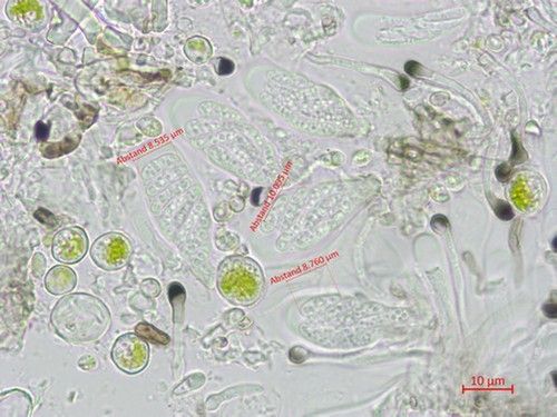 Catillaria nigroclavata - Ascus/Asci mit Sporen - Wasser  - 