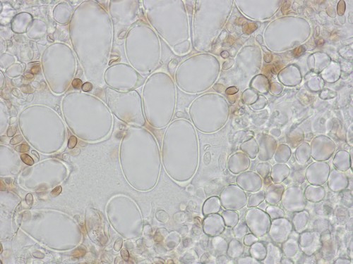 Coprinopsis stercorea - Zystiden - 