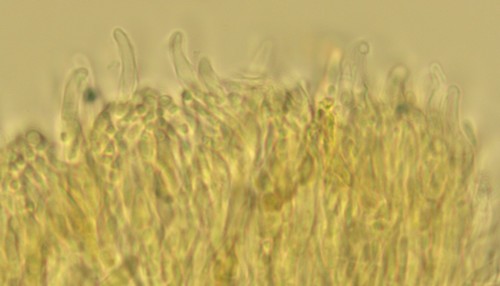 Psilocistella conicola - Haare -