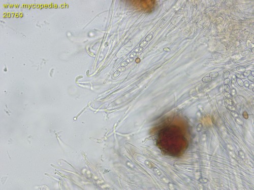 Otidea brevispora - Asci & Paraphysen - 