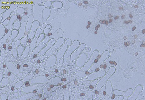 Candolleomyces candolleanus - Cheilozystiden - Ammoniak  - 